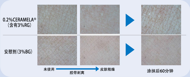 当皮肤粗燥导致肌理被破坏时，涂抹CERAMELA®后便可在短时间内得到修复。